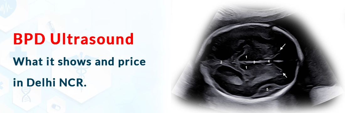 BPD Ultrasound: What it shows and price in Delhi NCR.